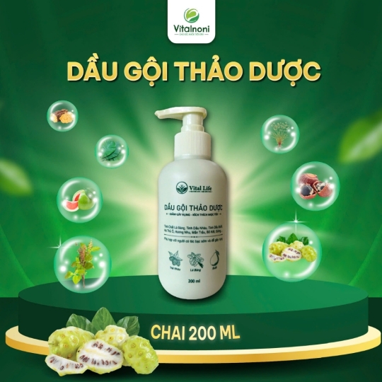 Sản phẩm 1
